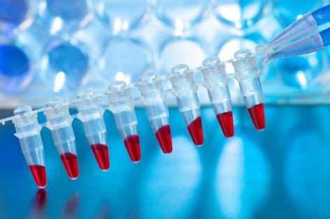 Допинг мельдоний обнаружен у красноярских регбистов «Енисей-СТМ»