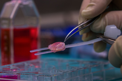 В России научились выращивать сетчатку глаза из перепрограммированных клеток