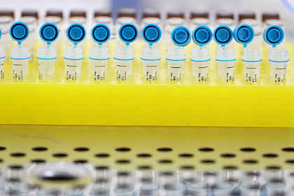 В России за сутки выявили свыше тысячи новых случаев заражения коронавирусом