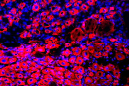 Открыт новый способ омолодить организм и продлить жизнь