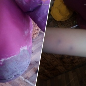 Бездомные собаки в «Солнечном» напали на ребенка около школы