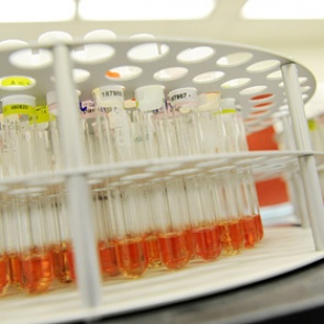 Новорожденному впервые пересадили стволовые клетки