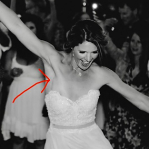 Фото со свадьбы помогло невесте выявить рак