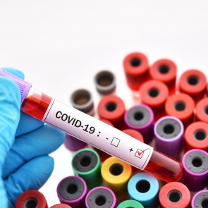 В Красноярском крае подтверждено еще 135 случаев Covid-19 и 14 смертей от него