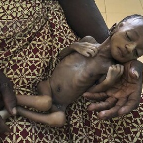 Стало известно о массовом голоде среди детей из-за пандемии